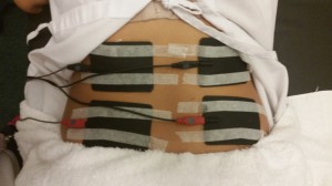electrotherapy